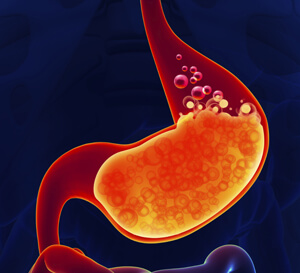 Acidity Indigestion